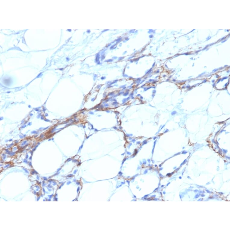 Immunohistochemistry - Anti-MYH11 Antibody [SPM201] - BSA and Azide free (A252639) - Antibodies.com