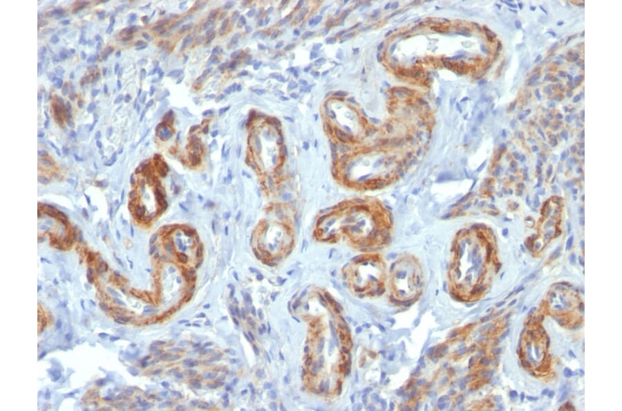 Immunohistochemistry - Anti-MYH11 Antibody [ID8] - BSA and Azide free (A252641) - Antibodies.com