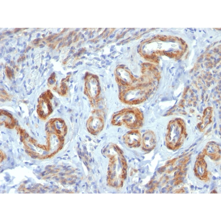 Immunohistochemistry - Anti-MYH11 Antibody [ID8] - BSA and Azide free (A252641) - Antibodies.com