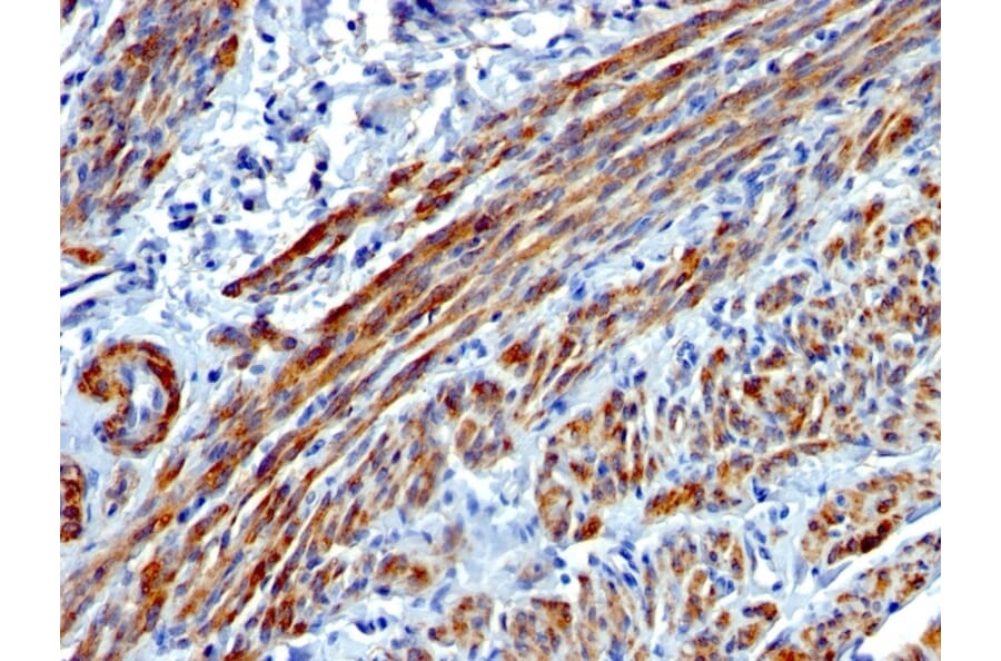 Immunohistochemistry - Anti-MYH11 Antibody [MYH11/923] - BSA and Azide free (A252642) - Antibodies.com