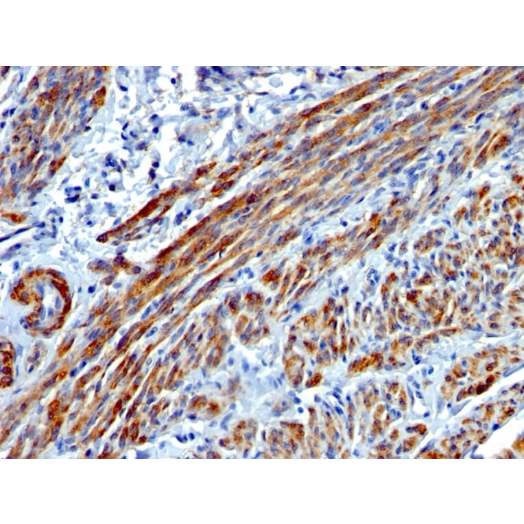 Immunohistochemistry - Anti-MYH11 Antibody [MYH11/923] - BSA and Azide free (A252642) - Antibodies.com
