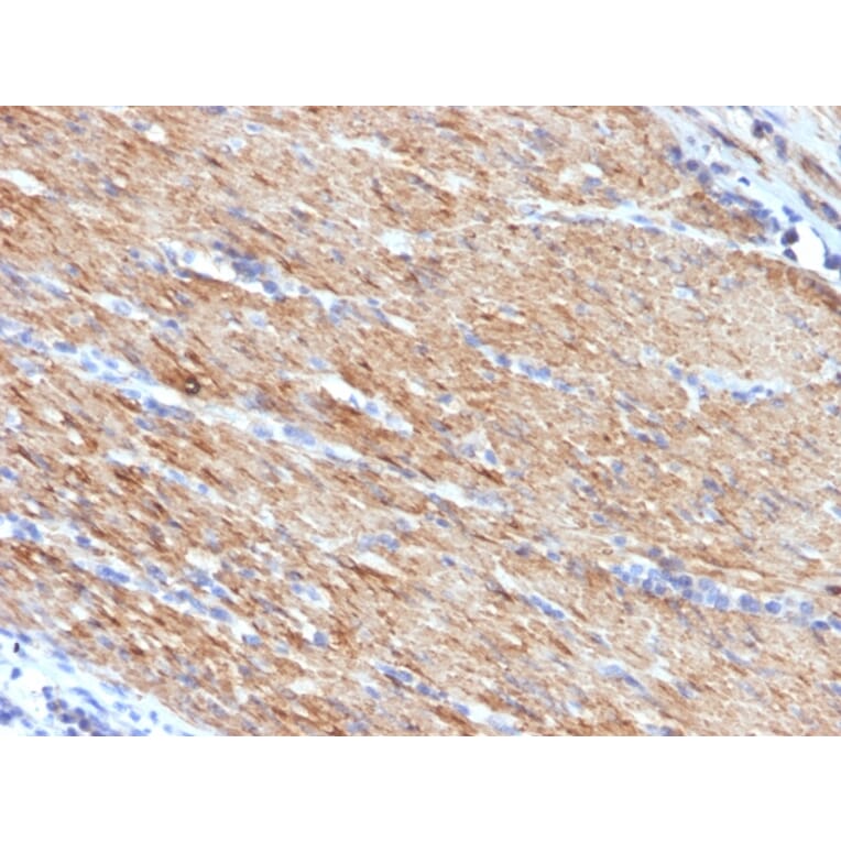 Immunohistochemistry - Anti-MYH11 Antibody [MYH11/923] - BSA and Azide free (A252642) - Antibodies.com