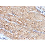 Immunohistochemistry - Anti-MYH11 Antibody [MYH11/923] - BSA and Azide free (A252642) - Antibodies.com