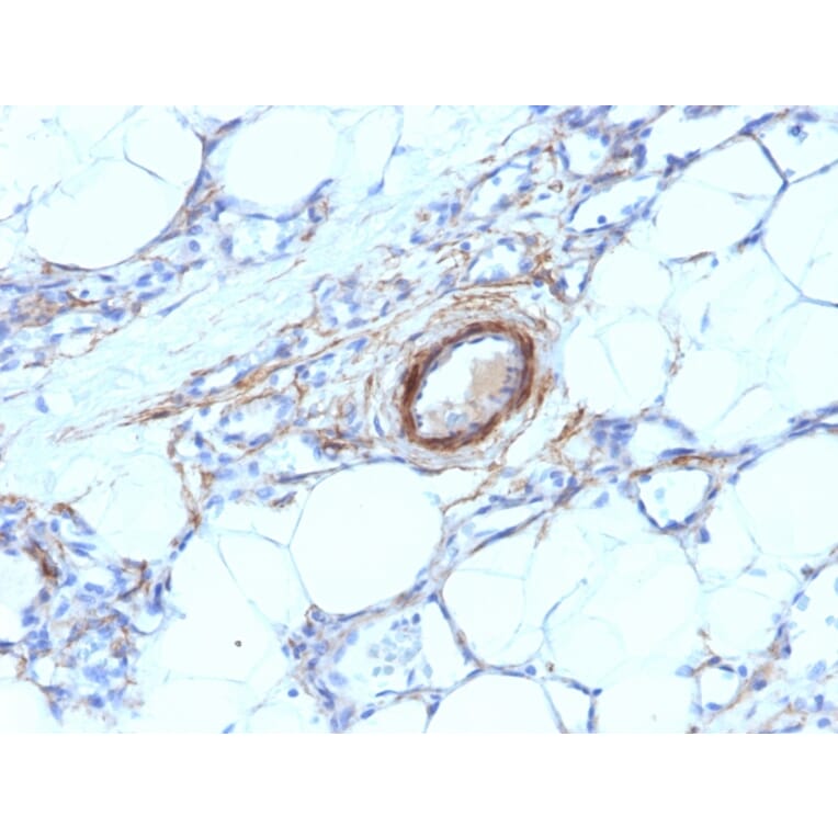 Immunohistochemistry - Anti-MYH11 Antibody [MYH11/923] - BSA and Azide free (A252641) - Antibodies.com