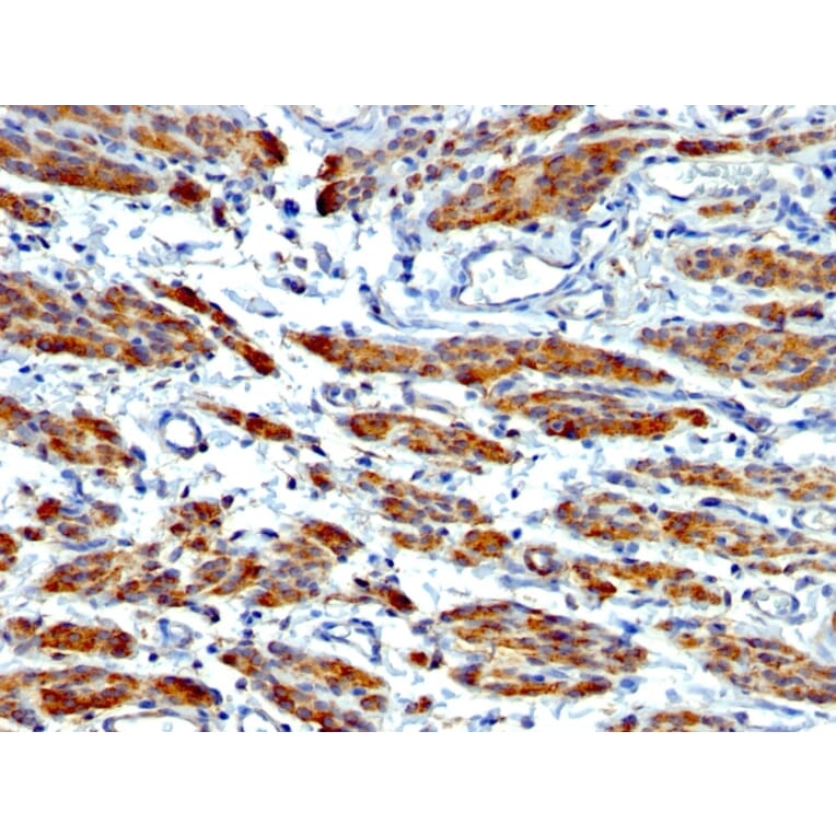 Immunohistochemistry - Anti-MYH11 Antibody [MYH11/923 + SMMS-1] - BSA and Azide free (A252643) - Antibodies.com