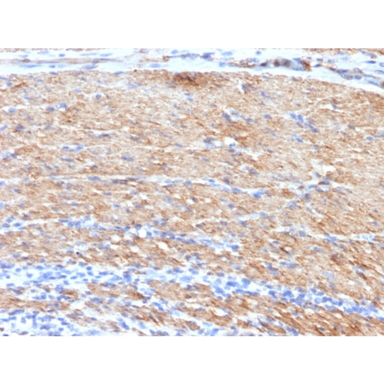 Immunohistochemistry - Anti-MYH11 Antibody [MYH11/923 + SMMS-1] - BSA and Azide free (A252643) - Antibodies.com