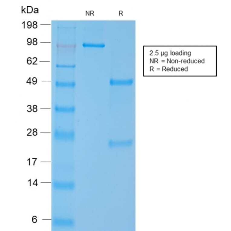 SDS-PAGE - Anti-MYH11 Antibody [MYH11/2303R] - BSA and Azide free (A252644) - Antibodies.com