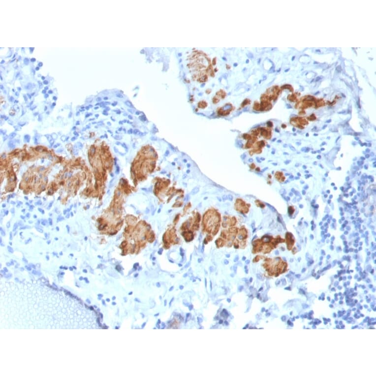 Immunohistochemistry - Anti-MYH11 Antibody [MYH11/2303R] - BSA and Azide free (A252644) - Antibodies.com