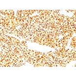 Immunohistochemistry - Anti-MyoD1 Antibody [SPM427] - BSA and Azide free (A252644) - Antibodies.com