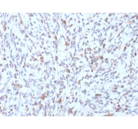 Immunohistochemistry - Anti-MyoD1 Antibody [rMYD712] - BSA and Azide free (A252646) - Antibodies.com
