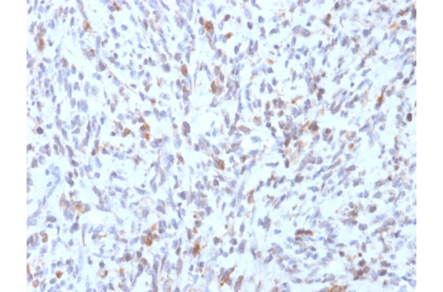 Immunohistochemistry - Anti-MyoD1 Antibody [rMYD712] - BSA and Azide free (A252646) - Antibodies.com