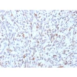 Immunohistochemistry - Anti-MyoD1 Antibody [rMYD712] - BSA and Azide free (A252646) - Antibodies.com