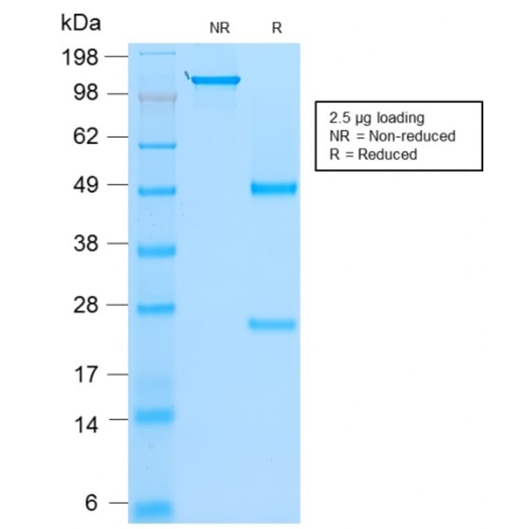 SDS-PAGE - Anti-MyoD1 Antibody [rMYD712] - BSA and Azide free (A252646) - Antibodies.com