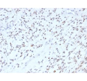 Immunohistochemistry - Anti-MyoD1 Antibody [MYOD1/2075R] - BSA and Azide free (A252647) - Antibodies.com
