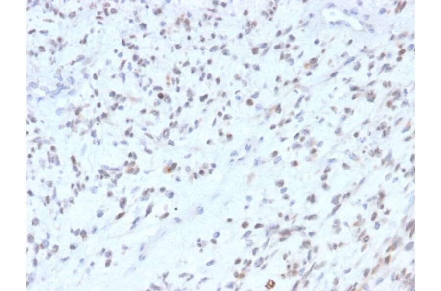 Immunohistochemistry - Anti-MyoD1 Antibody [MYOD1/2075R] - BSA and Azide free (A252647) - Antibodies.com