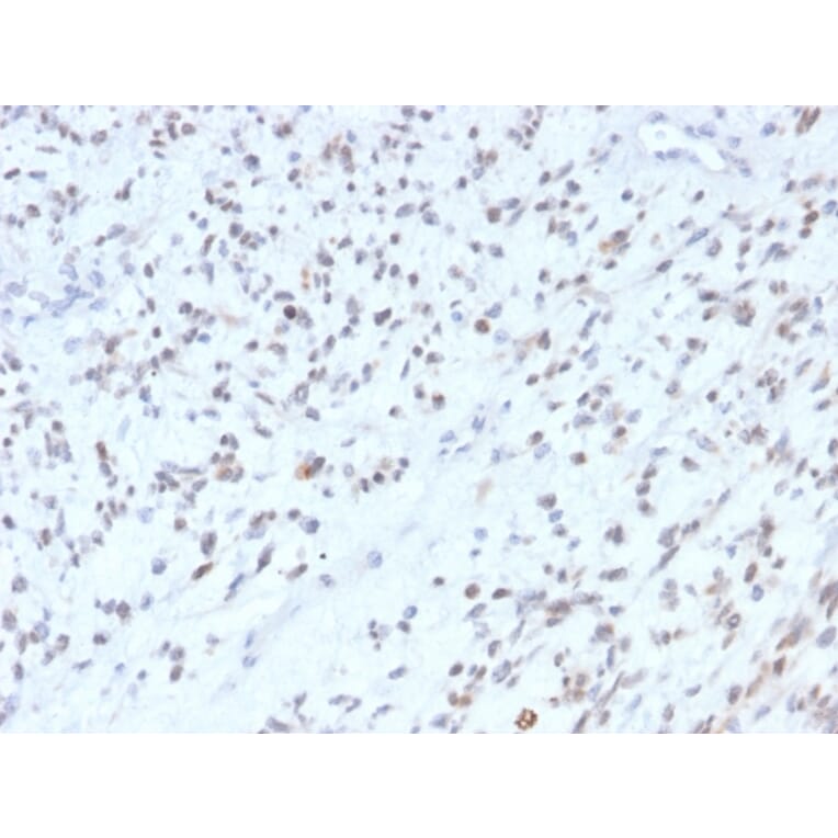 Immunohistochemistry - Anti-MyoD1 Antibody [MYOD1/2075R] - BSA and Azide free (A252647) - Antibodies.com