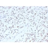 Immunohistochemistry - Anti-MyoD1 Antibody [MYOD1/2075R] - BSA and Azide free (A252647) - Antibodies.com