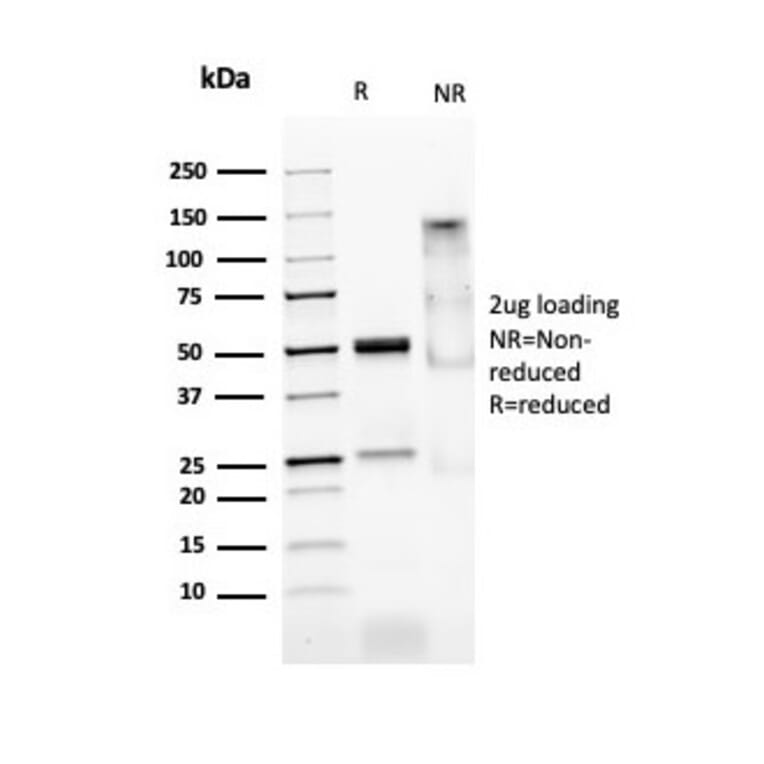 SDS-PAGE - Anti-MyoD1 Antibody [MYOD1/2075R] - BSA and Azide free (A252647) - Antibodies.com