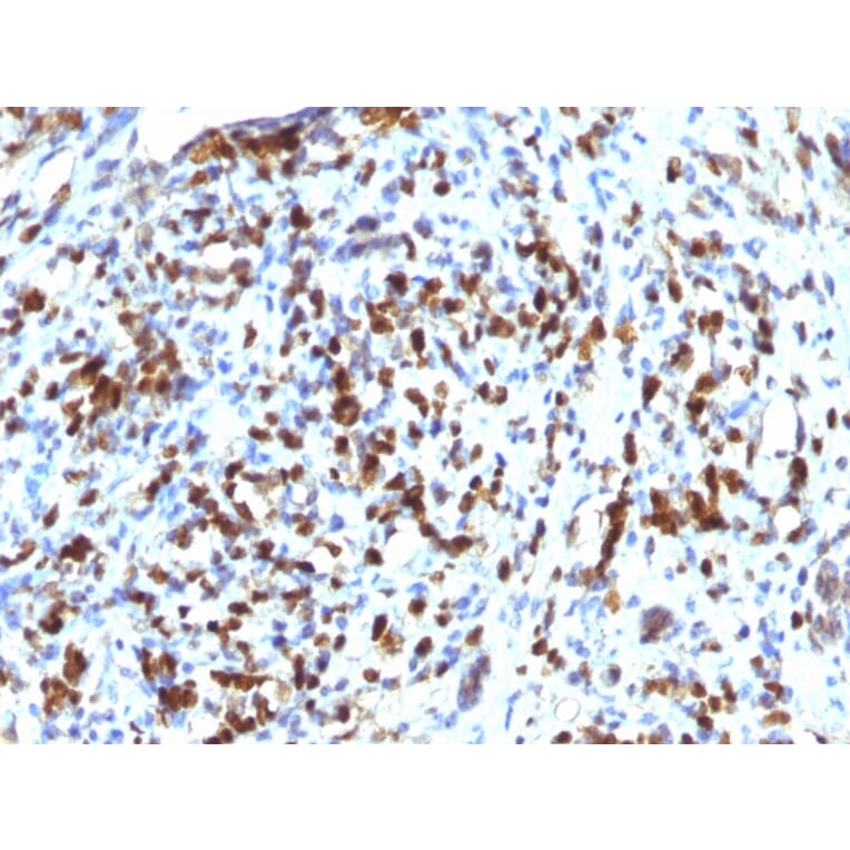 Immunohistochemistry - Anti-MyoD1 Antibody [MYOD1/2075R] - BSA and Azide free (A252647) - Antibodies.com