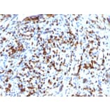 Immunohistochemistry - Anti-MyoD1 Antibody [MYOD1/2075R] - BSA and Azide free (A252647) - Antibodies.com