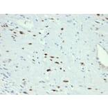 Immunohistochemistry - Anti-MyoD1 Antibody [MYOD1/3418R] - BSA and Azide free (A252648) - Antibodies.com