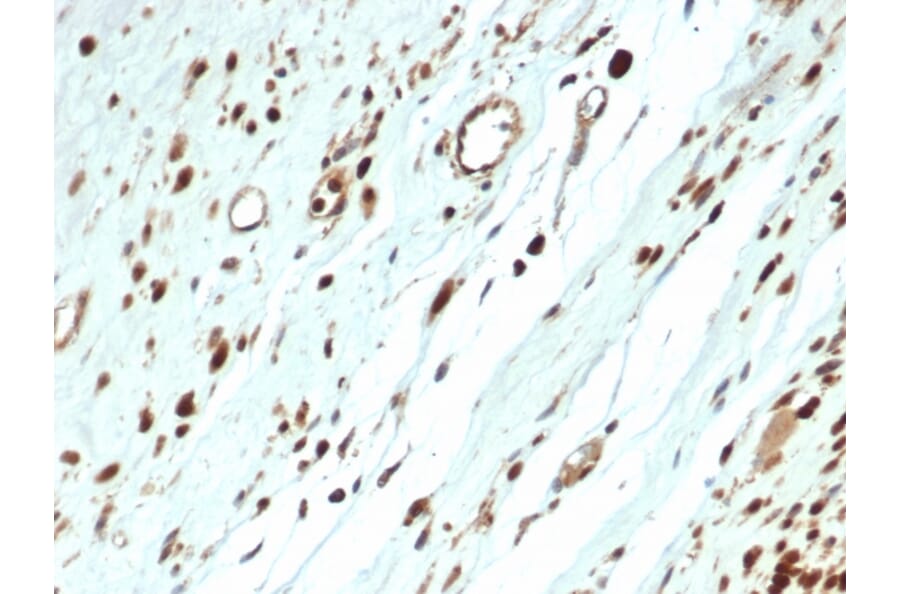 Immunohistochemistry - Anti-MyoD1 Antibody [MYOD1/3418R] - BSA and Azide free (A252647) - Antibodies.com