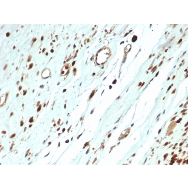 Immunohistochemistry - Anti-MyoD1 Antibody [MYOD1/3418R] - BSA and Azide free (A252647) - Antibodies.com