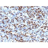 Immunohistochemistry - Anti-Myogenin Antibody [MGN185] - BSA and Azide free (A252648) - Antibodies.com