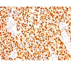 Immunohistochemistry - Anti-Myogenin Antibody [SPM144] - BSA and Azide free (A252650) - Antibodies.com