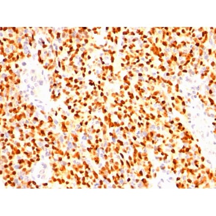 Immunohistochemistry - Anti-Myogenin Antibody [SPM144] - BSA and Azide free (A252650) - Antibodies.com