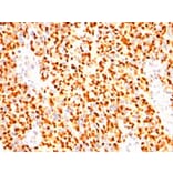 Immunohistochemistry - Anti-Myogenin Antibody [SPM144] - BSA and Azide free (A252650) - Antibodies.com