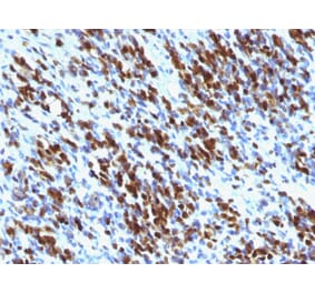Immunohistochemistry - Anti-Myogenin Antibody [MGN185 + F5D] - BSA and Azide free (A252651) - Antibodies.com