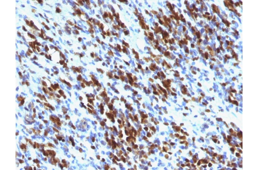 Immunohistochemistry - Anti-Myogenin Antibody [MGN185 + F5D] - BSA and Azide free (A252651) - Antibodies.com