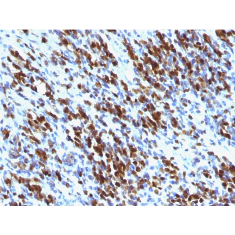 Immunohistochemistry - Anti-Myogenin Antibody [MGN185 + F5D] - BSA and Azide free (A252651) - Antibodies.com