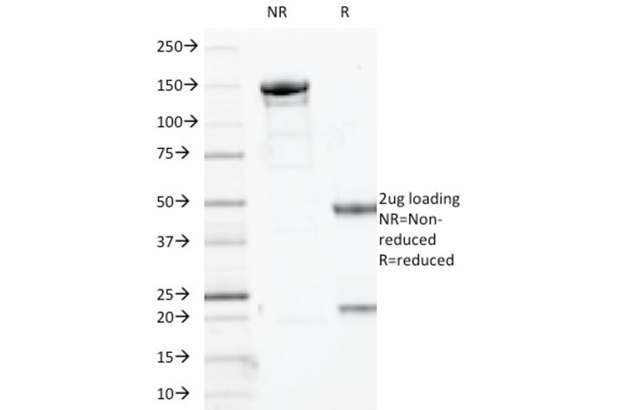 SDS-PAGE - Anti-Myogenin Antibody [MYOG/2660] - BSA and Azide free (A252653) - Antibodies.com