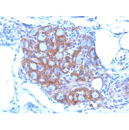 Immunohistochemistry - Anti-NCAM1 Antibody [SPM128] - BSA and Azide free (A252655) - Antibodies.com