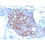 Immunohistochemistry - Anti-NCAM1 Antibody [SPM128] - BSA and Azide free (A252655) - Antibodies.com
