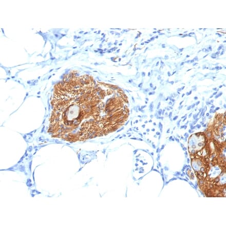 Immunohistochemistry - Anti-NCAM1 Antibody [123A8] - BSA and Azide free (A252655) - Antibodies.com