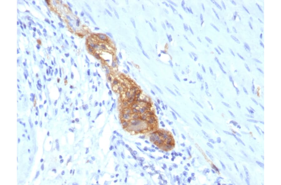 Immunohistochemistry - Anti-NCAM1 Antibody [SPM489] - BSA and Azide free (A252656) - Antibodies.com