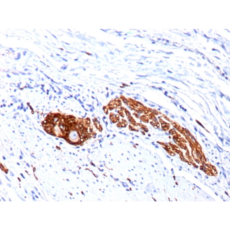 Immunohistochemistry - Anti-NCAM1 Antibody [123C3.D5 + 123A8] - BSA and Azide free (A252657) - Antibodies.com