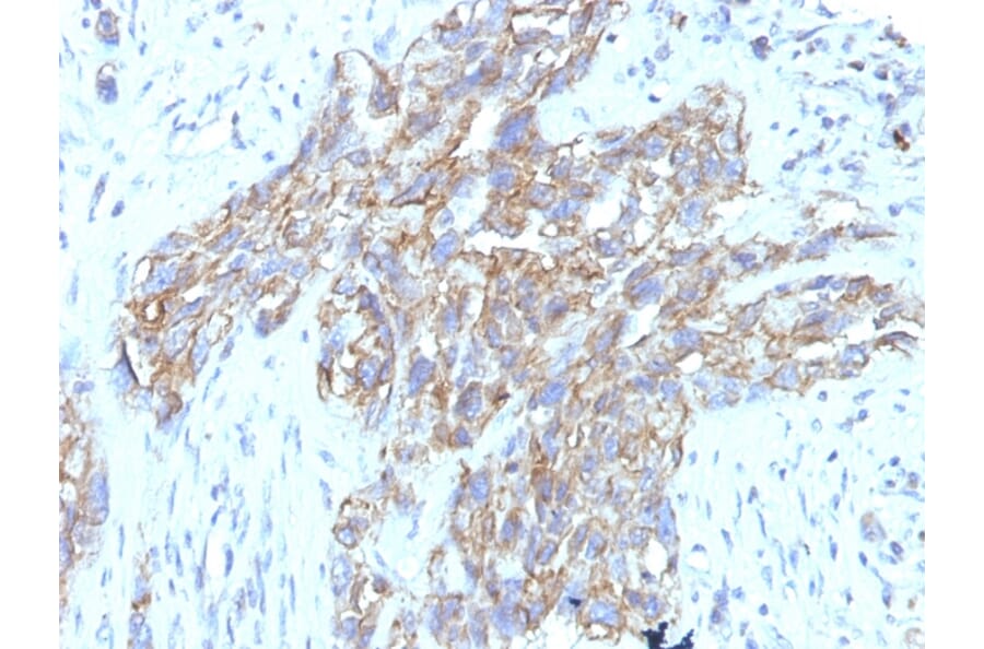 Immunohistochemistry - Anti-NCAM1 Antibody [123C3.D5 + 123A8] - BSA and Azide free (A252658) - Antibodies.com
