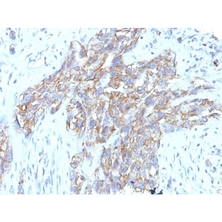 Immunohistochemistry - Anti-NCAM1 Antibody [123C3.D5 + 123A8] - BSA and Azide free (A252658) - Antibodies.com