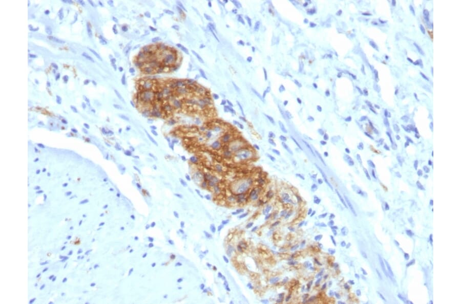 Immunohistochemistry - Anti-NCAM1 Antibody [NCAM1/784] - BSA and Azide free (A252658) - Antibodies.com