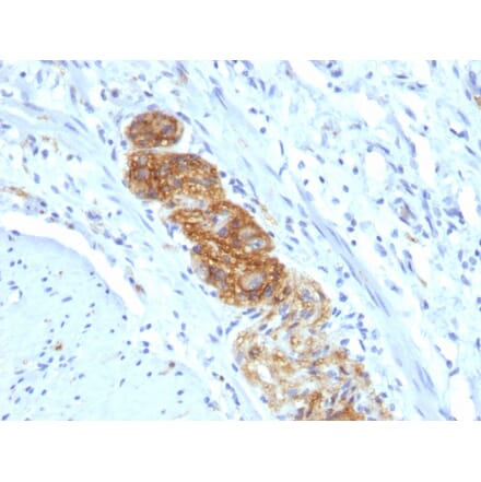 Immunohistochemistry - Anti-NCAM1 Antibody [NCAM1/784] - BSA and Azide free (A252658) - Antibodies.com