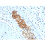 Immunohistochemistry - Anti-NCAM1 Antibody [NCAM1/784] - BSA and Azide free (A252658) - Antibodies.com
