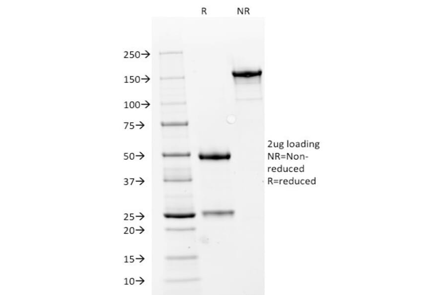SDS-PAGE - Anti-NCAM1 Antibody [NCAM1/784] - BSA and Azide free (A252659) - Antibodies.com