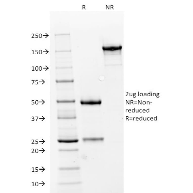 SDS-PAGE - Anti-NCAM1 Antibody [NCAM1/784] - BSA and Azide free (A252659) - Antibodies.com