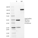 SDS-PAGE - Anti-NCAM1 Antibody [NCAM1/784] - BSA and Azide free (A252659) - Antibodies.com