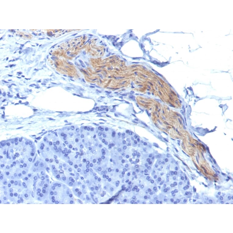 Immunohistochemistry - Anti-NCAM1 Antibody [NCAM1/795] - BSA and Azide free (A252660) - Antibodies.com
