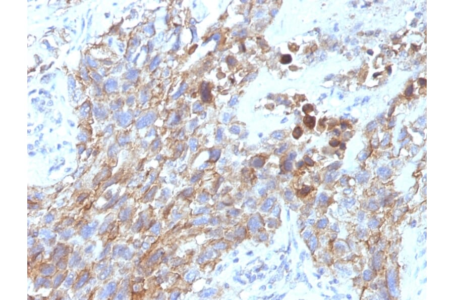 Immunohistochemistry - Anti-NCAM1 Antibody [NCAM1/795] - BSA and Azide free (A252659) - Antibodies.com
